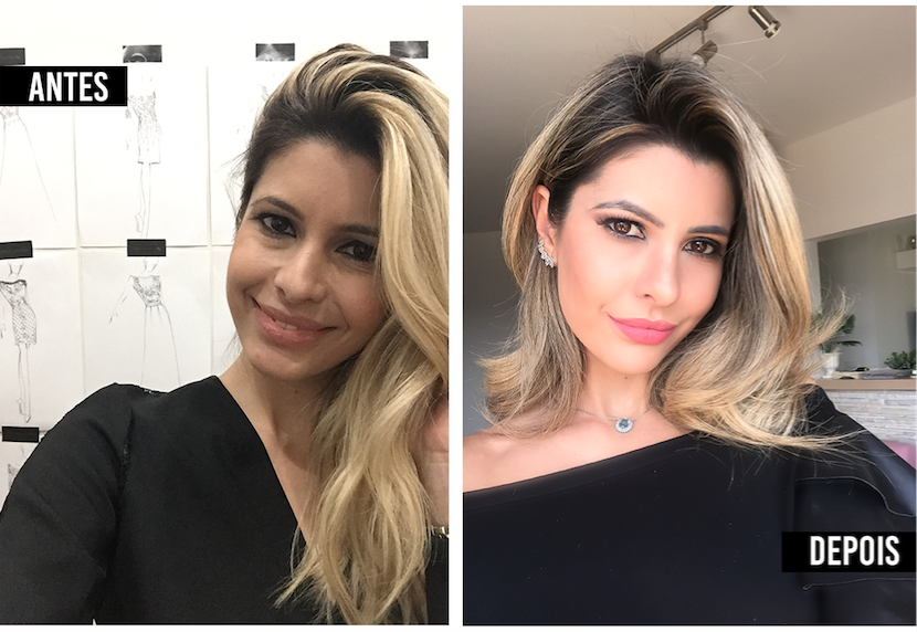 Ficando linda com botox – MEU ANTES E DEPOIS